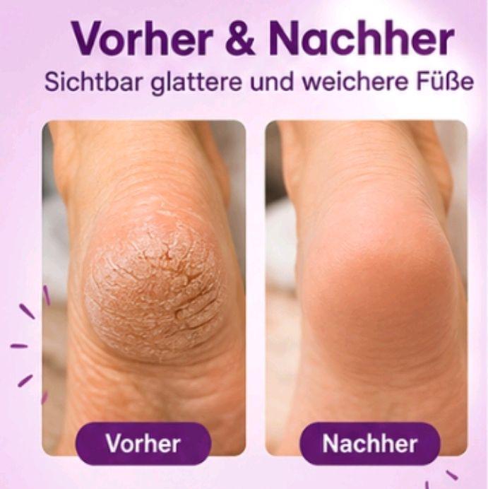 Fuß-Peeling-Spray 200 ml gegen Hornhaut – für samtweiche Füße
